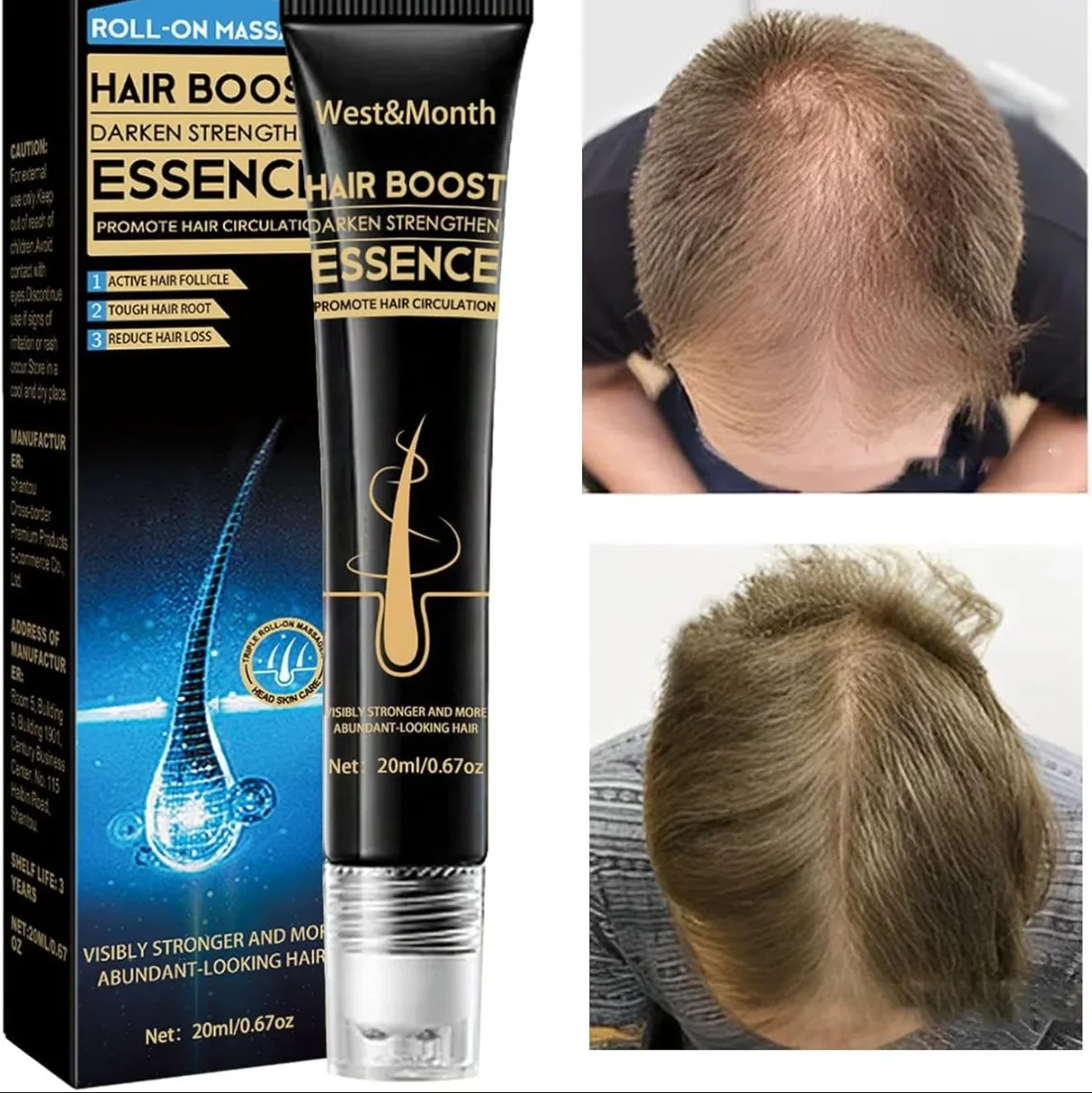 Serum acelerador y fortalecedor ✨ Deluxe MAX 💇🏼♀️ (Estimula el crecimiento en días) - Imagen 5